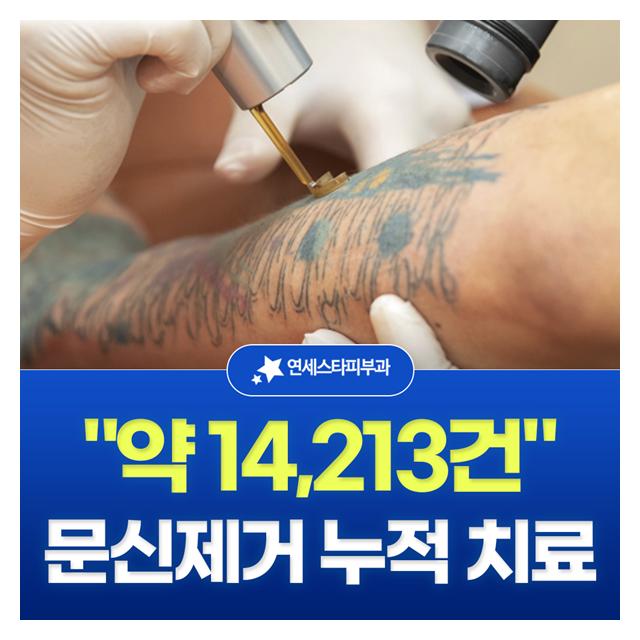 문신제거 누적 치료 약14,213건 연세스타피부과