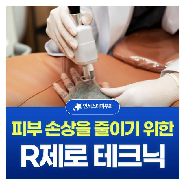 R제로 테크닉 피부 손상을 줄이기 위한 시술